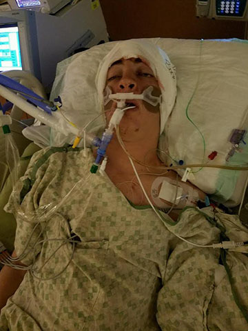Joshell Green  fighting for his life after surviving his first three-and-a-half hour emergency surgery following the shooting.
