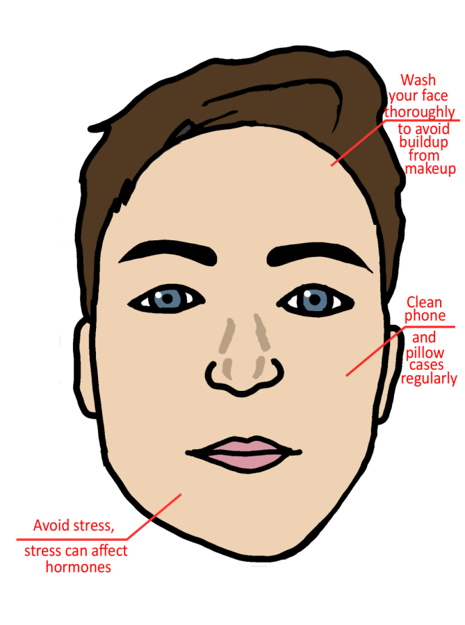 Jons Face acne COLOR